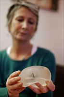 Una donna francese mostra una protesi mammaria della società Pip (foto Ansa).