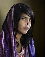 La foto dell'anno 2010 del World Press Photo: è il ritratto di una ragazza afghana mutilata dai talebani (Jodi Bibier, Institute for artist management/Goodman gallery per il Time magazine).