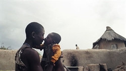Un'immagine che documenta il progetto di Msf contro la malnutrizione in Burkina Faso (foto di Jessica Dimmock/ VII Network; sua anche la foto di copertina di questo servizio).