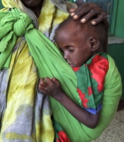 Un bambino gravemente malnutrito con la madre al Benadir Hospital, a Mogadiscio, in Somalia (Foto: AP)