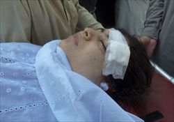 Malala Yousafzai, la ragazzina pachistana di 14 anni ferita dai talebani il 9 ottobre. Tutte le foto di questo servizio, compresa quella di copertina, sono dell'agenzia Ansa.