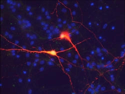 Immagine del neurone ottenuto dal gruppo di ricerca del San Raffaele di Milano.