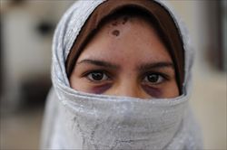 Amira, una ragazzina siriana vittima di violenze. Foto Kate Brooks/Unicef.